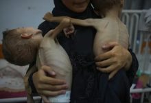 صورة 17 مؤسسة حقوقية تُكذب “ويتكوف”: أدلة مجاعة غزة ملموسة ولا تُمحى بالتصريحات