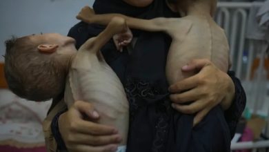 صورة 17 مؤسسة حقوقية تُكذب “ويتكوف”: أدلة مجاعة غزة ملموسة ولا تُمحى بالتصريحات
