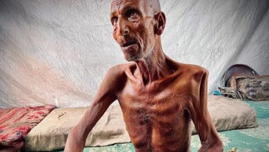 صورة مدير مجمع الشفاء: المجاعة تفتك بأطفال غزة والعالم مطالب برؤية الحقيقة