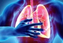 صورة اليوم العالمي لسرطان الرئة.. مؤشرات تنذر ووسائل علاجية