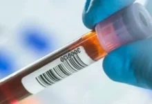 صورة هل الصيام ضروري قبل إجراء تحليل الدهون والكولسترول؟