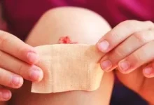صورة ما هي إصابة إزالة الجلد وهل يمكن علاجها؟