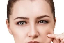 صورة الأكل المالح وقلة النوم أبرزها.. أسباب انتفاخ الوجه صباحًا وطرق العلاج الفعالة