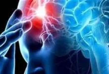 صورة يصيب الرياضيين ويؤثر على الانفعالات.. ما هو الاعتلال الدماغي المزمن