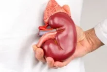 صورة ما التأثيرات التي تطرأ على كليتيك نتيجة قلة شرب الماء؟