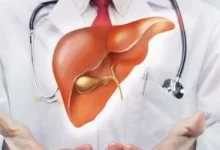 صورة ما هي الصلة بين متلازمة تكيس المبايض ومرض الكبد الدهني؟