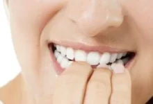 صورة قضم الأظافر ليس عادة سيئة فحسب.. بل قد يؤدي إلى الإصابة بهذه العدوى الخطيرة