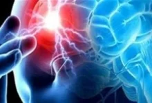 صورة دراسة تكشف أن أدمغة القطط المصابة بالخرف تتشابه مع أدمغة البشر المرضى