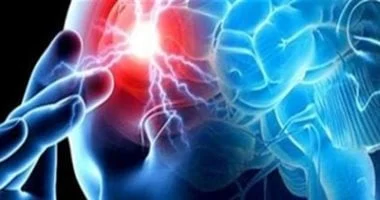 صورة دراسة تكشف أن أدمغة القطط المصابة بالخرف تتشابه مع أدمغة البشر المرضى