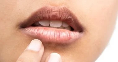 صورة 6 علامات تظهر على الشفتين تدل على مشاكل صحية كامنة