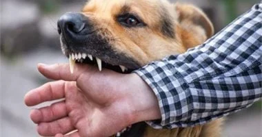 صورة عاجل: كيفية التعامل إذا تعرض طفلك لعضة أو خدش من كلب لوقايته من الإصابة بالسعار