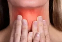 صورة إجابات على أهم 10 أسئلة حول الغدة الدرقية