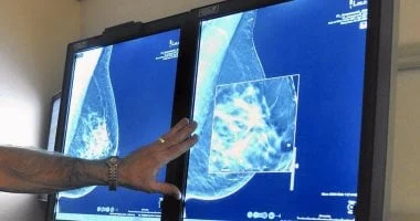 صورة هل يؤدي الإشعاع الناتج عن الفحوصات الطبية إلى زيادة خطر الإصابة بسرطان الثدي؟