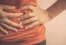 صورة الفتق بعد الجراحة: الأسباب والأعراض وطرق العلاج