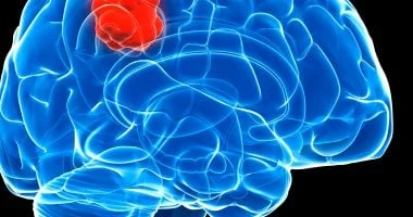 صورة دراسة تكشف سبب مقاومة بعض أورام المخ للعلاج الإشعاعي وتعتمد نهجا علاجيا جديدا
