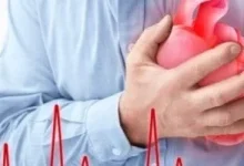 صورة كوبولا يخضع لعملية جديدة بعد 30 عاماً.. ما هو الرجفان الأذيني
