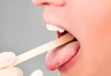 صورة 6 علامات تظهر في فمك تدل على مشكلات صحية ومعها 6 نصائح مهمة