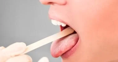 صورة 6 علامات تظهر في فمك تدل على مشكلات صحية ومعها 6 نصائح مهمة