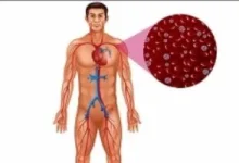 صورة أعراض ضعف الدورة الدموية والأمراض التي قد تدل عليها