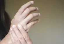 صورة أطعمة مضادة للالتهابات تقلل من آلام المفاصل