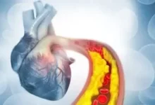 صورة خرافات الكوليسترول: توقف عن تصديقها حفاظاً على صحة قلبك