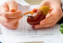 صورة دراسة تظهر أن تناول هذه المكملات الغذائية يؤدي إلى تكون حصوات الكلى لدى الرجال.