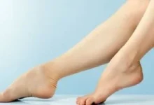 صورة أبرز 6 أسئلة يطرحها مريض الدوالى على الطبيب وإجاباتها الوافية