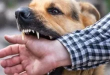 صورة 5 علامات لا تهملها إذا تعرضت لعضة كلب