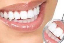 صورة دليلك الذهبي للعناية بصحة الأسنان: ماذا تأكل وماذا تتجنب؟