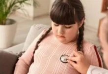 صورة أستاذ جراحة يعلق على فيديو تكميم معدة لطفلة خضعت لعملية لا رجعة فيها