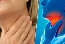 صورة أسباب طبية وراء حرقة الحلق ونصائح لعلاجها بفعالية