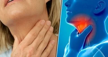 صورة أسباب طبية وراء حرقة الحلق ونصائح لعلاجها بفعالية