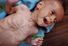 صورة 8 وفيات بينهم طفل نتيجة المجاعة بغزة خلال الـ24 ساعة الماضية