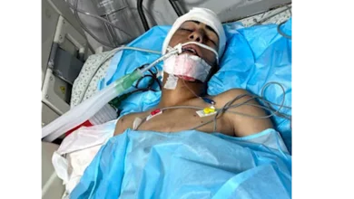 صورة أصيب بشلل نصفي.. كيف تحطم حلم لاعب كرة قدم في غزة برصاص الاحتلال