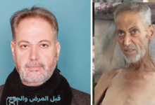 صورة استشهاد الكاتب الدكتور عمر حرب بسبب سوء التغذية في غزة