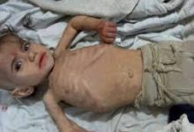 صورة الصحة : 13 حالة وفاة في غزة بسبب المجاعة وسوء التغذية