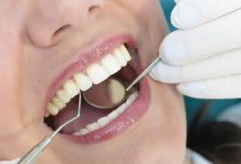 صورة أعراض خفية قد تنذر بمشاكل خطيرة في الأسنان.. متى تحتاج لمراجعة أخصائي التقويم؟
