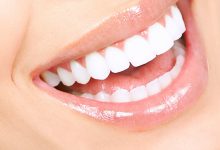صورة أخصائي: ربط ابتسامة هوليود بالتركيبات والعدسات مفهوم خاطيء