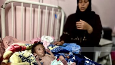 صورة الصحة : 6 وفيات جديدة بسبب التجويع بغزة خلال 24 ساعة