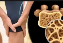 صورة 5 أطعمة يجب الاهتمام بتناولها بعد سن الثلاثين للحفاظ على صحة عظامك