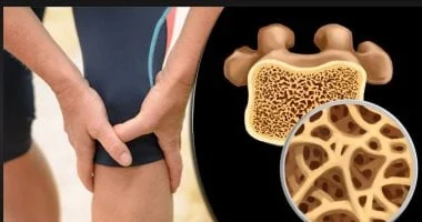 صورة 5 أطعمة يجب الاهتمام بتناولها بعد سن الثلاثين للحفاظ على صحة عظامك