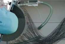 صورة ابتكار خوذة بالموجات فوق الصوتية لتحفيز مناطق الدماغ العميقة دون جراحة