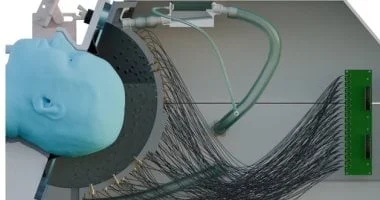 صورة ابتكار خوذة بالموجات فوق الصوتية لتحفيز مناطق الدماغ العميقة دون جراحة