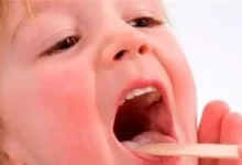 صورة مش دلع.. عسر البلع عند الأطفال مشكلة تستدعي العلاج وهذه أهم النصائح
