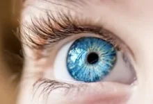 صورة أعراض انسداد القناة الدمعية لدى طفلك وسبل العلاج